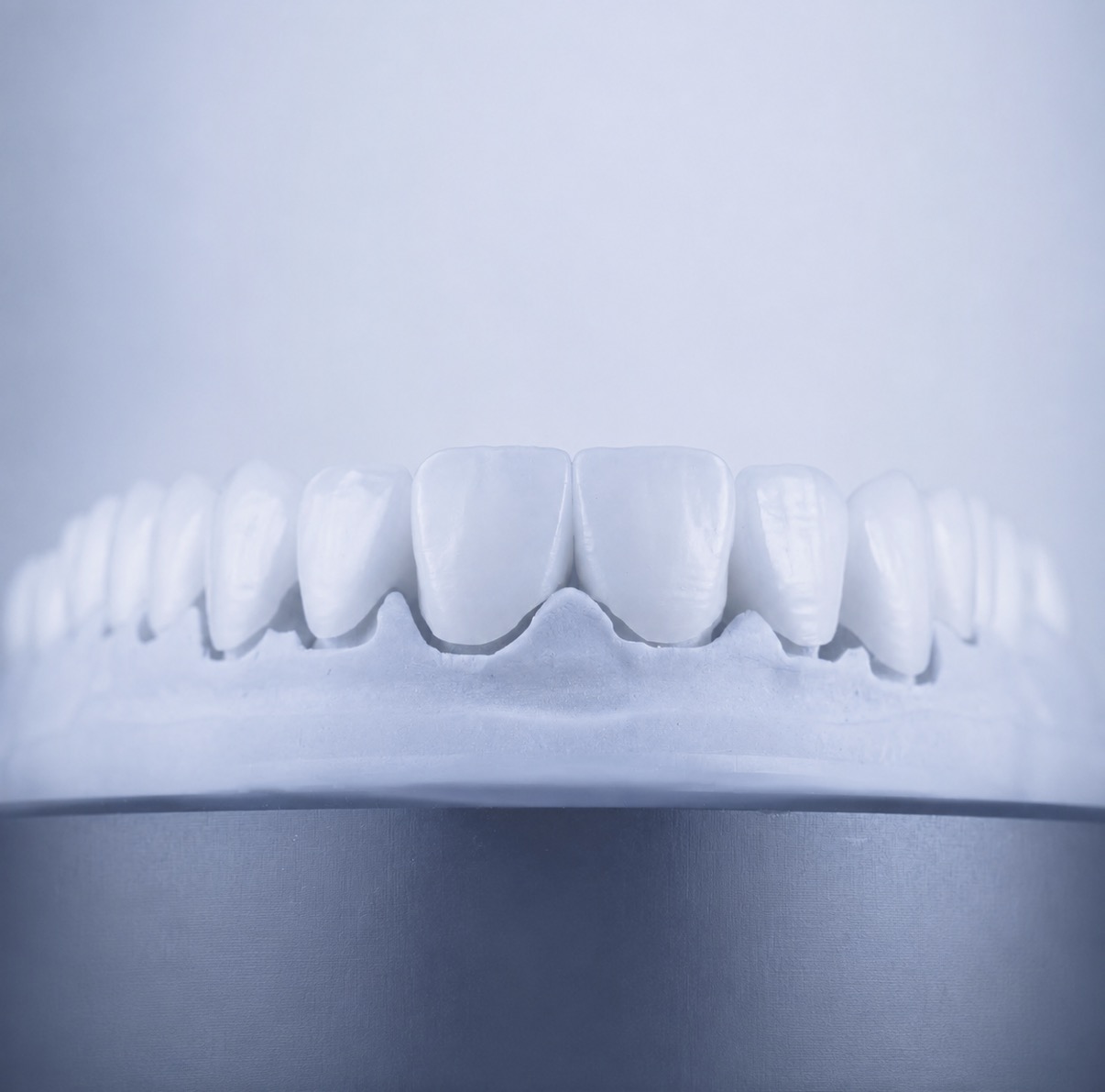 Shërbimi i fasetave dentare