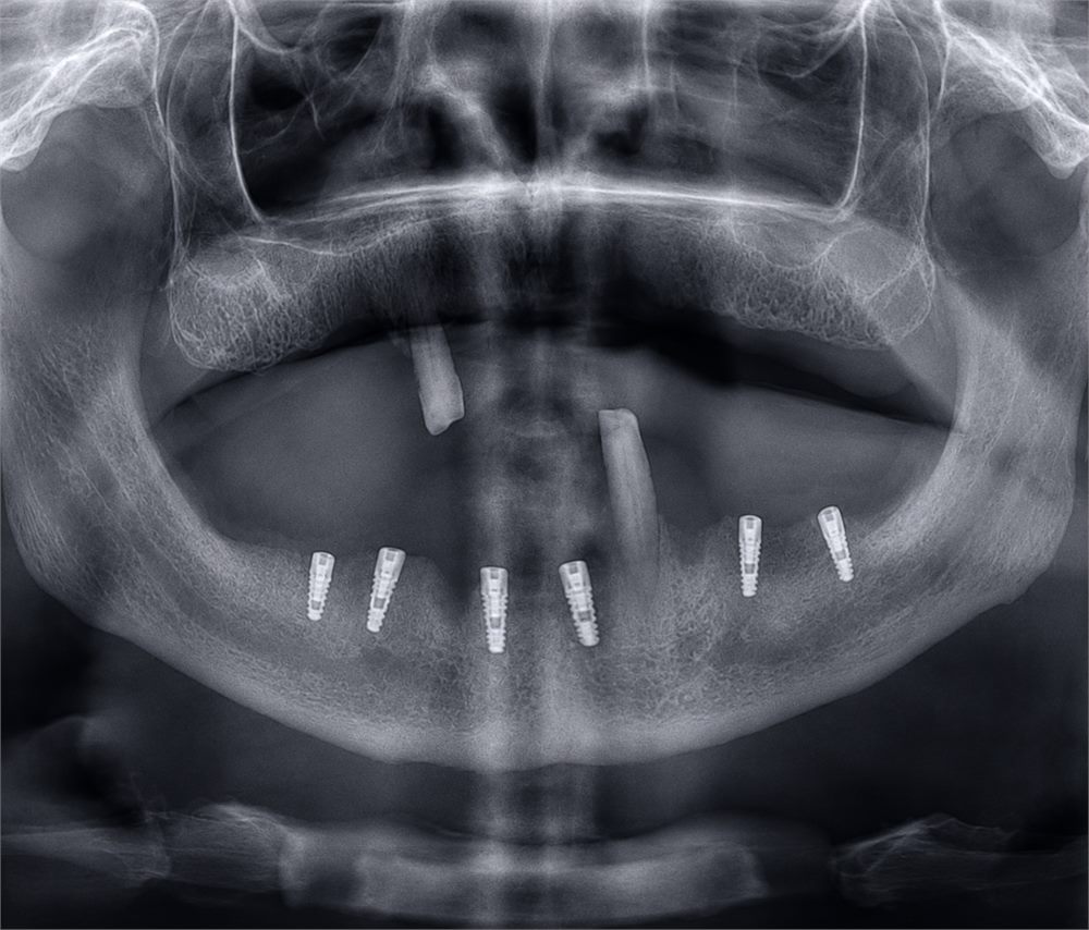 Radiografi dentare